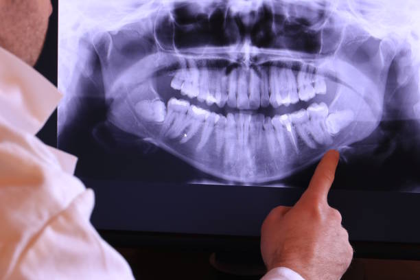 Best Emergency Dentist for Knocked-Out Tooth in Knollwood, IL