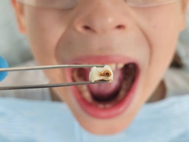 Best Emergency Dental Services for Seniors in Knollwood, IL